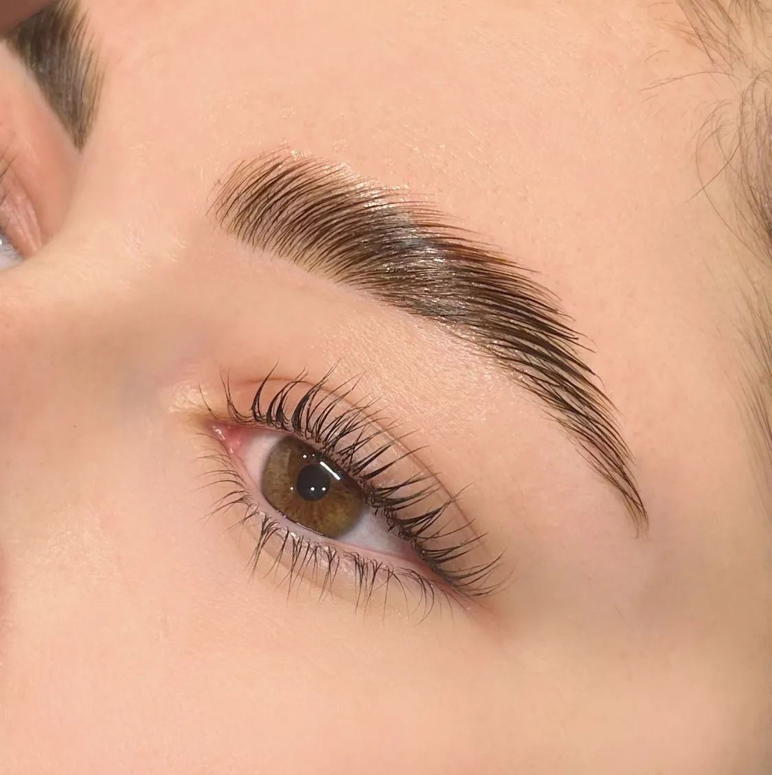 Sourcil rehaussé après un browlift réalisé en formation